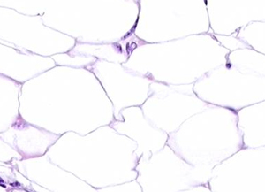 adipose tissue under microscope